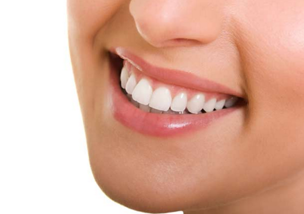 Hampaiden valkaisu vetyperoksidilla vai karbamidiperoksidilla